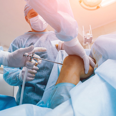 Knee Arthroscopy in Guntur